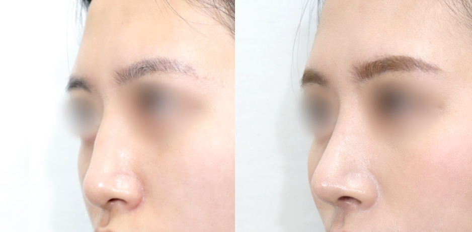 Newline Clinic — recent post 1