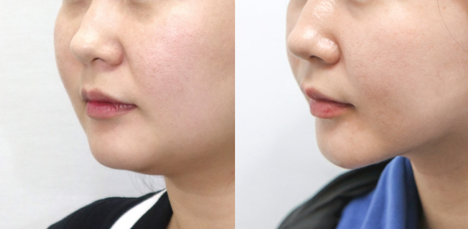 Newline Clinic — recent post 6